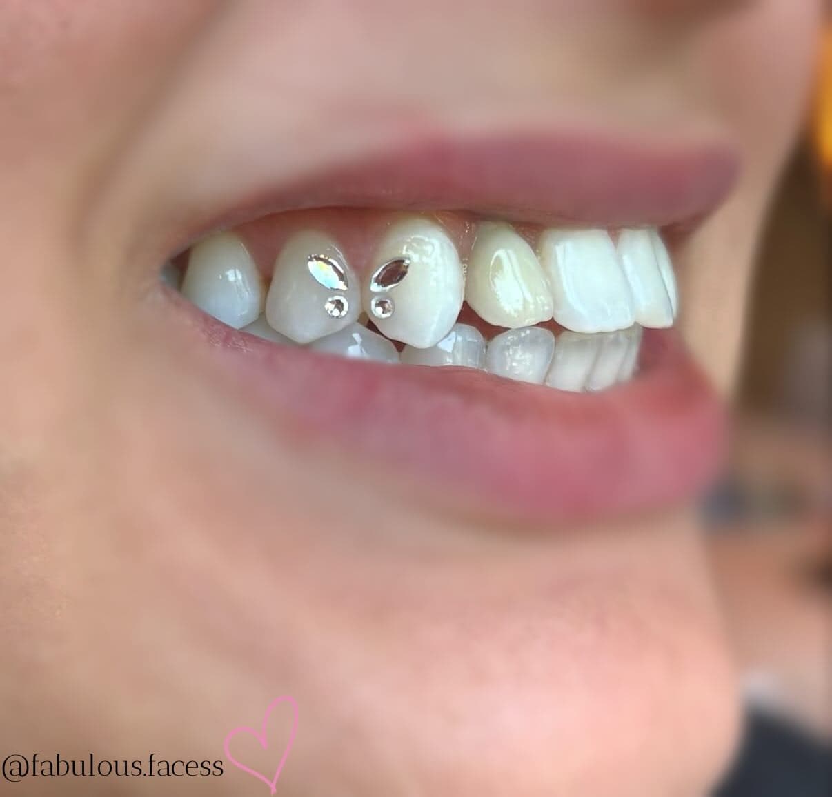 Teeth Diamond Accent